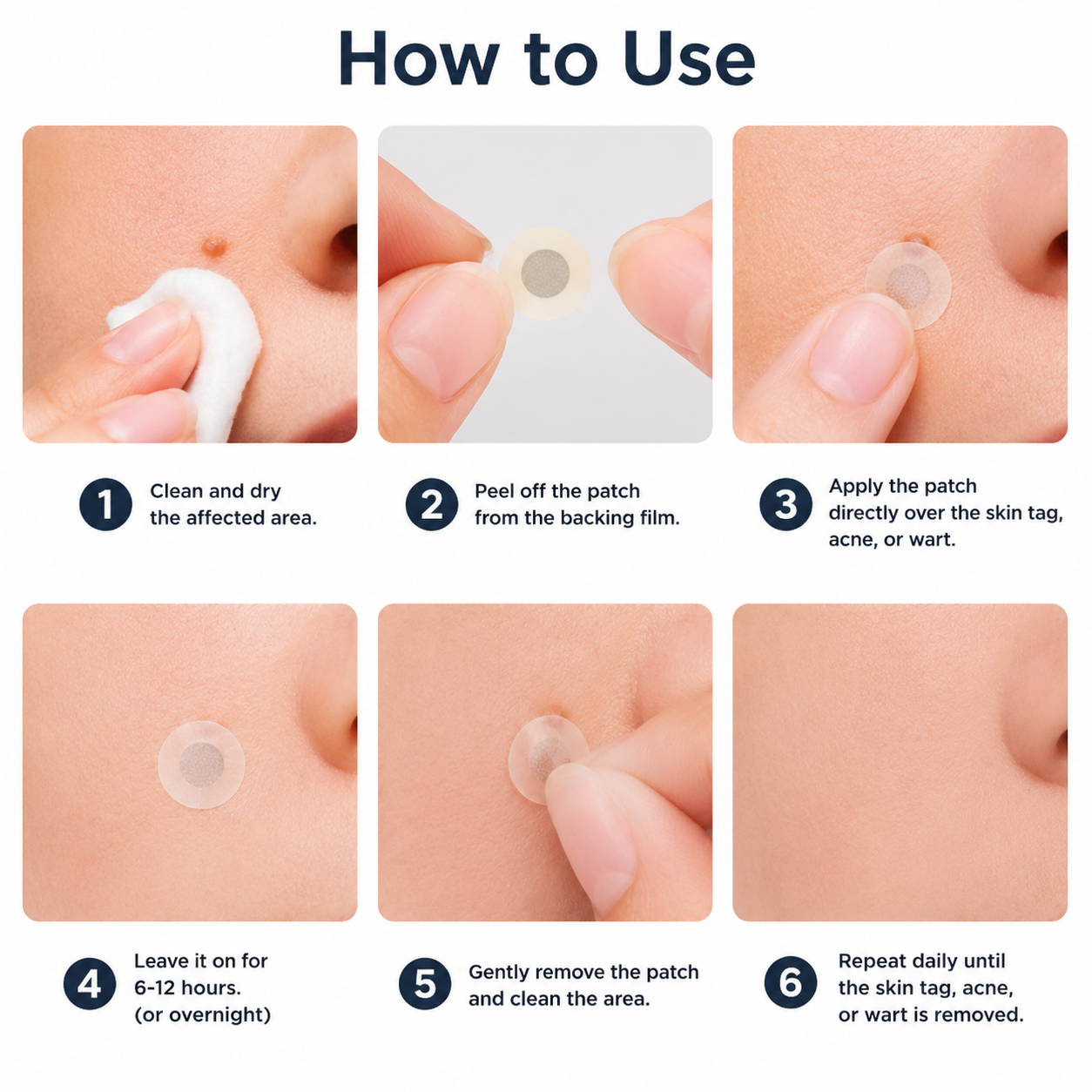 ✨✨ShapeOil®2-in-1 Microneedle & Hydrocolloid Patch🍀| Removes Raised Moles, Acne, Flat Warts & Skin Tags | Helps Improve Wrinkles, Scars & Blemishes | Invisible Patches for Face & Body