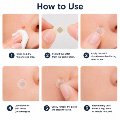✨✨ShapeOil®2-in-1 Microneedle & Hydrocolloid Patch🍀| Removes Raised Moles, Acne, Flat Warts & Skin Tags | Helps Improve Wrinkles, Scars & Blemishes | Invisible Patches for Face & Body